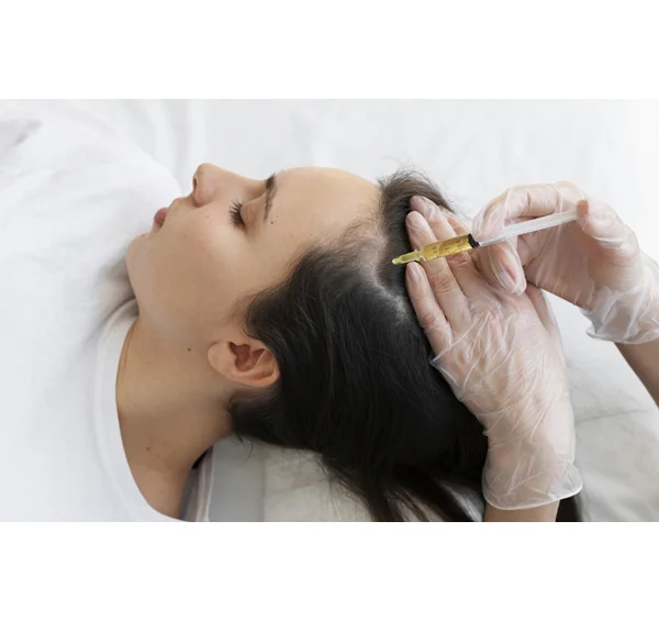 Hairfall Treatment